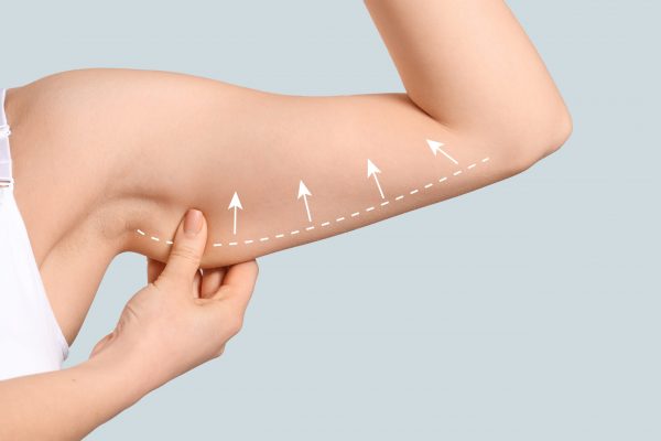 Arm,Of,Young,Woman,After,Slimming,On,Light,Background.,Plastic