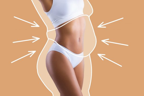 tummy tuck